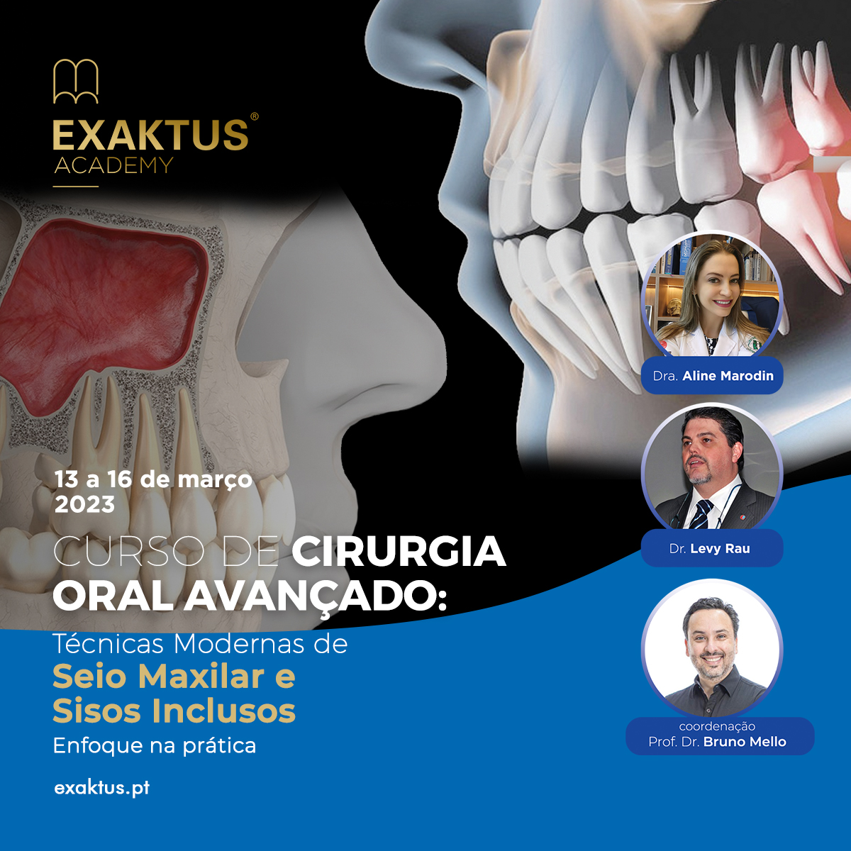 CIRURGIA ORAL AVANÇADO: TÉCNICAS MODERNAS DE SEIO MAXILAR E SISOS INCLUSOS