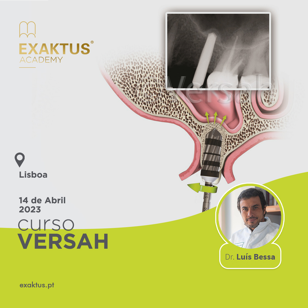 CURSO VERSAH - LISBOA